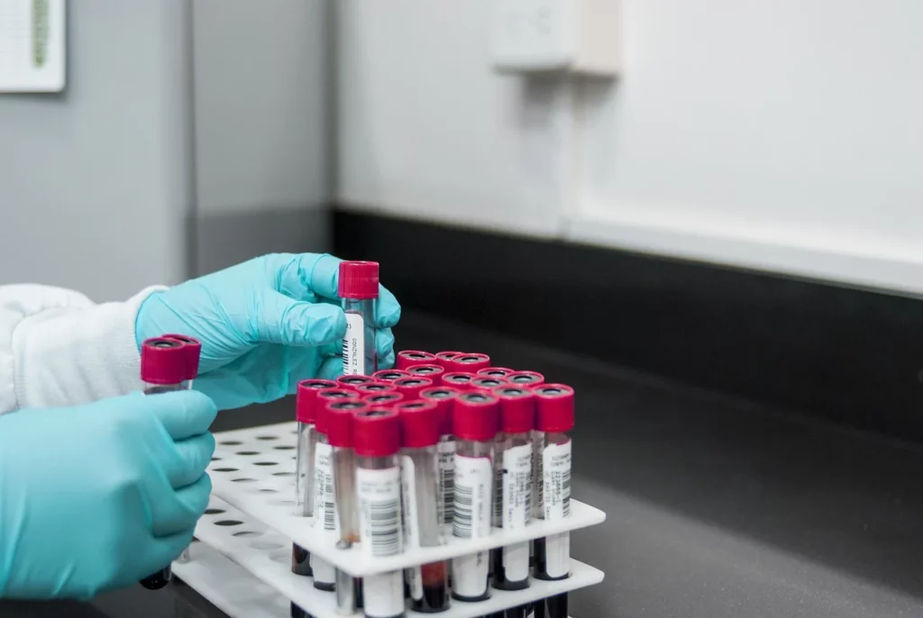Harmonieren eine künstliche Befruchtung und ganzheitliche Kinderwunschbehandlungen wirklich? 10 157 lab 3498584 1280